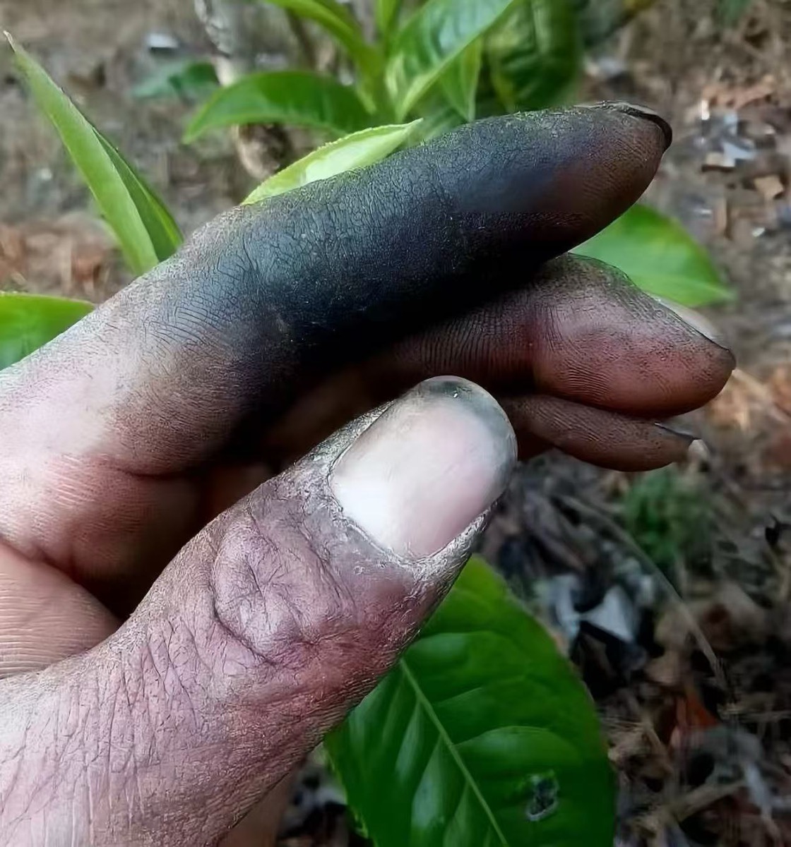 A tea picker's hands stained by tannins
